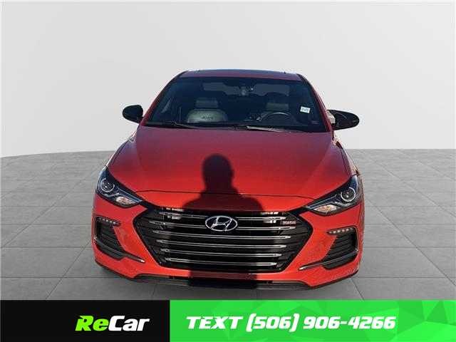 2017 Hyundai Elantra Sport